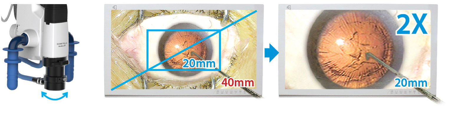 Sometech - VOMS 100 Microscope